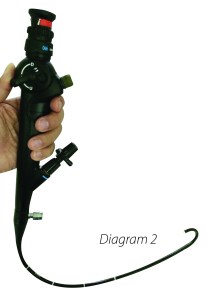 Diagram 2 showing a flexible cystoscope2