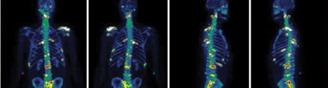 Dr Sunil Chopra Article - For Essenze Submission (1).jpg