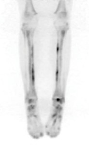 dr-sunil-chopra-article-for-essenze-submission-3