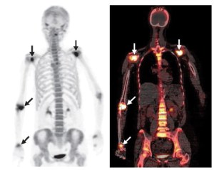 dr-sunil-chopra-article-for-essenze-submission-5