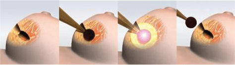 Screen Shot 2017-11-10 at 1.37.42 PM.png